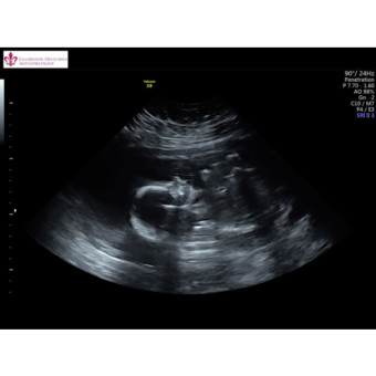 Babylist Registry Photo.