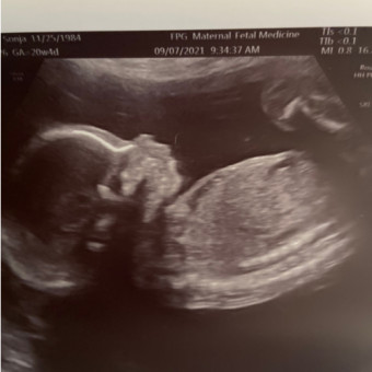 Babylist Registry Photo.