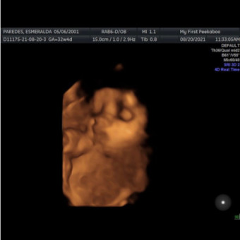 Babylist Registry Photo.