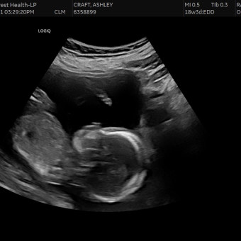 Babylist Registry Photo.