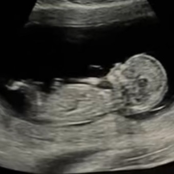 Babylist Registry Photo.