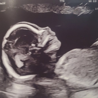 Babylist Registry Photo.