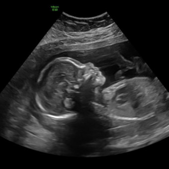 Babylist Registry Photo.