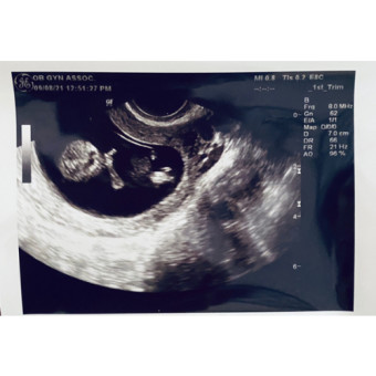 Babylist Registry Photo.