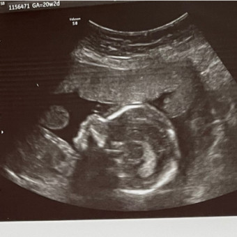 Babylist Registry Photo.