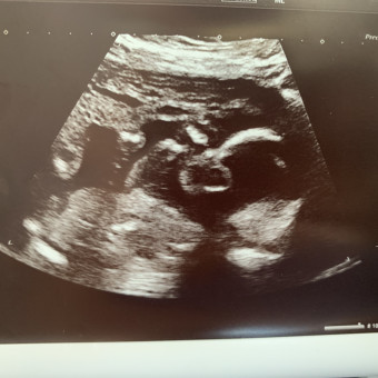 Babylist Registry Photo.