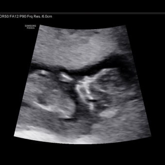 Babylist Registry Photo.