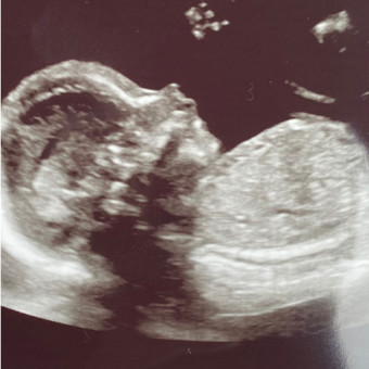 Babylist Registry Photo.