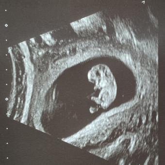 Babylist Registry Photo.