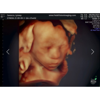 Babylist Registry Photo.