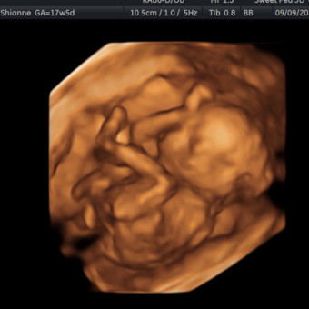 Babylist Registry Photo.
