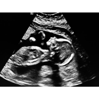 Babylist Registry Photo.