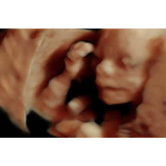 Babylist Registry Photo.