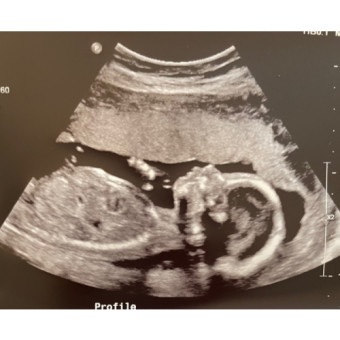 Babylist Registry Photo.