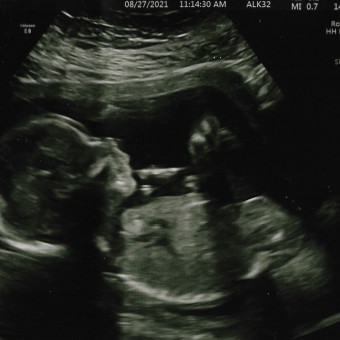 Babylist Registry Photo.