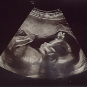 Babylist Registry Photo.