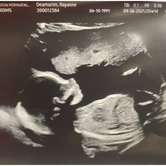 Babylist Registry Photo.