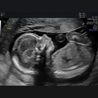 Babylist Registry Photo.
