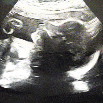 Babylist Registry Photo.