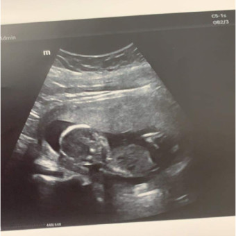 Babylist Registry Photo.
