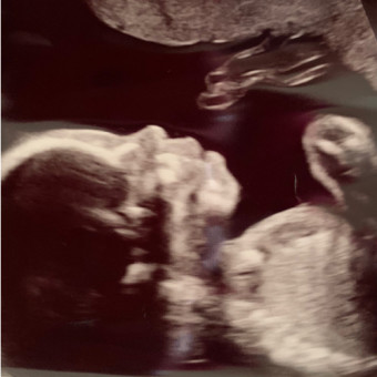 Babylist Registry Photo.