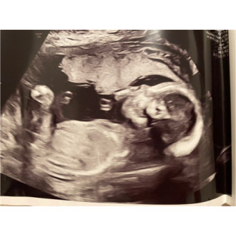 Babylist Registry Photo.