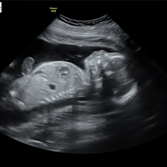 Babylist Registry Photo.