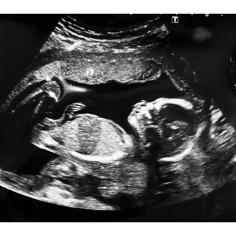 Babylist Registry Photo.