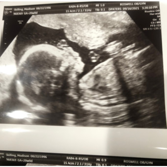 Babylist Registry Photo.