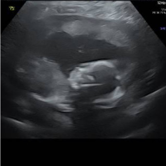 Babylist Registry Photo.