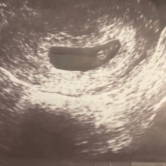 Babylist Registry Photo.