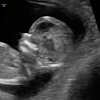 Babylist Registry Photo.