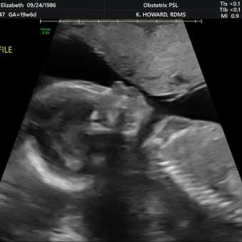 Babylist Registry Photo.