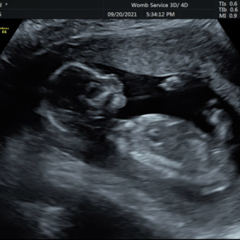 Babylist Registry Photo.