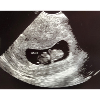 Babylist Registry Photo.