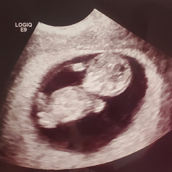 Babylist Registry Photo.