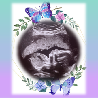 Babylist Registry Photo.