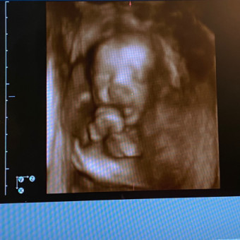 Babylist Registry Photo.