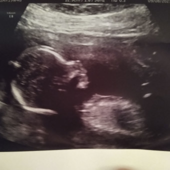 Babylist Registry Photo.