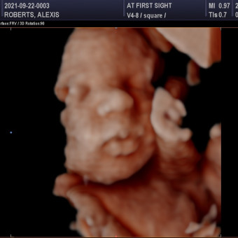 Babylist Registry Photo.