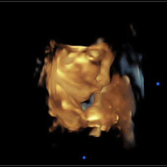Babylist Registry Photo.