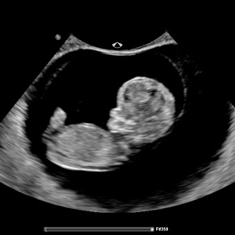 Babylist Registry Photo.