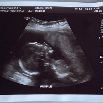 Babylist Registry Photo.