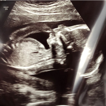 Babylist Registry Photo.