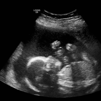 Babylist Registry Photo.