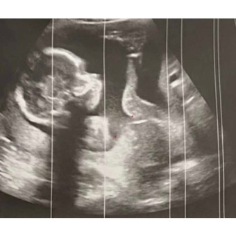 Babylist Registry Photo.