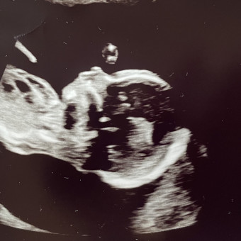 Babylist Registry Photo.