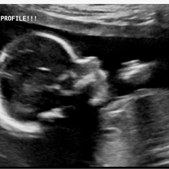 Babylist Registry Photo.