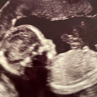Babylist Registry Photo.