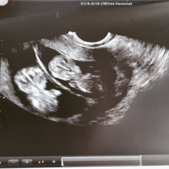 Babylist Registry Photo.